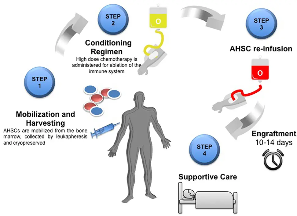 Eine grafische Darstellung der Stammzelltransplantation bei einem Patienten mit Multipler Sklerose