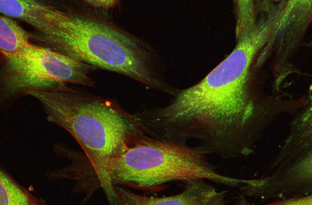 UCMSC Stammzellen