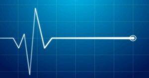 Elektrokardiogrammwellen auf einem digitalen Display